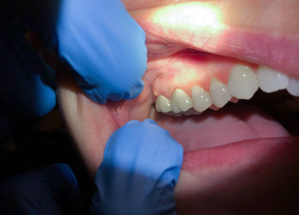 Best Emergency Dentist for Special Needs Patients in Hampton, GA