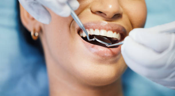 Best Emergency Dental Extractions in Hampton, GA